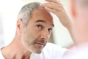 combination treatment for hair loss