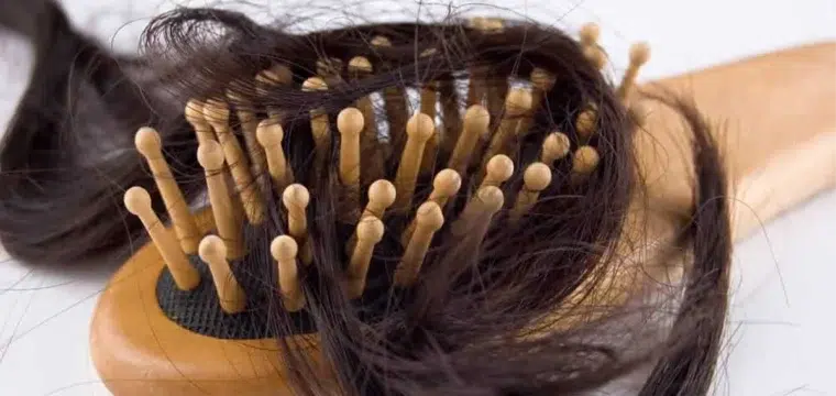 cancer-and-hair-loss-what-are-your-options