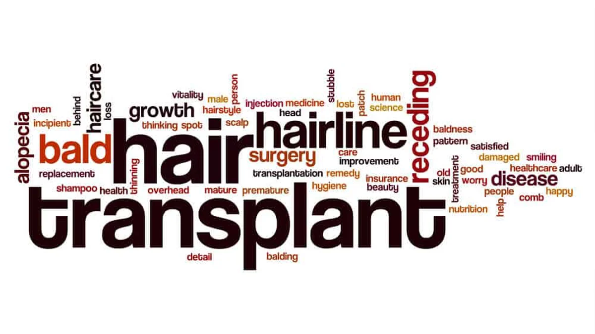 hair-transplant-a-permanent-or-temporary-solution