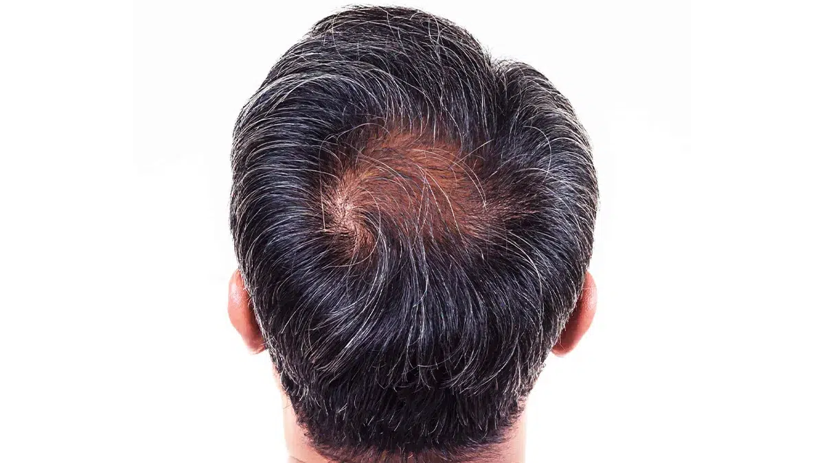 3 Ways Aging Affects Our Hair