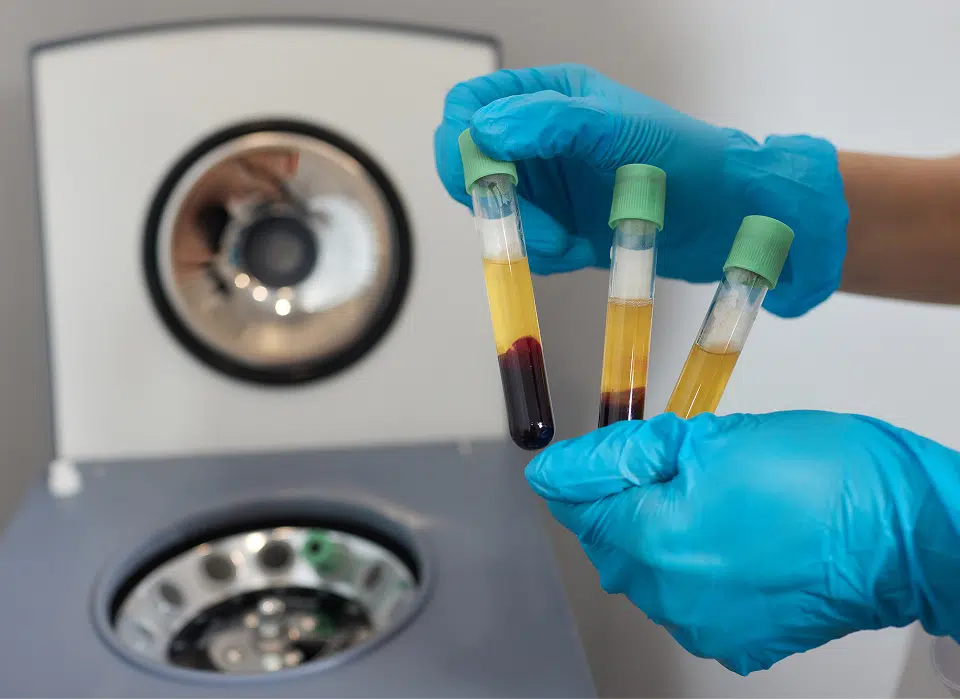 Growth Factor Therapy