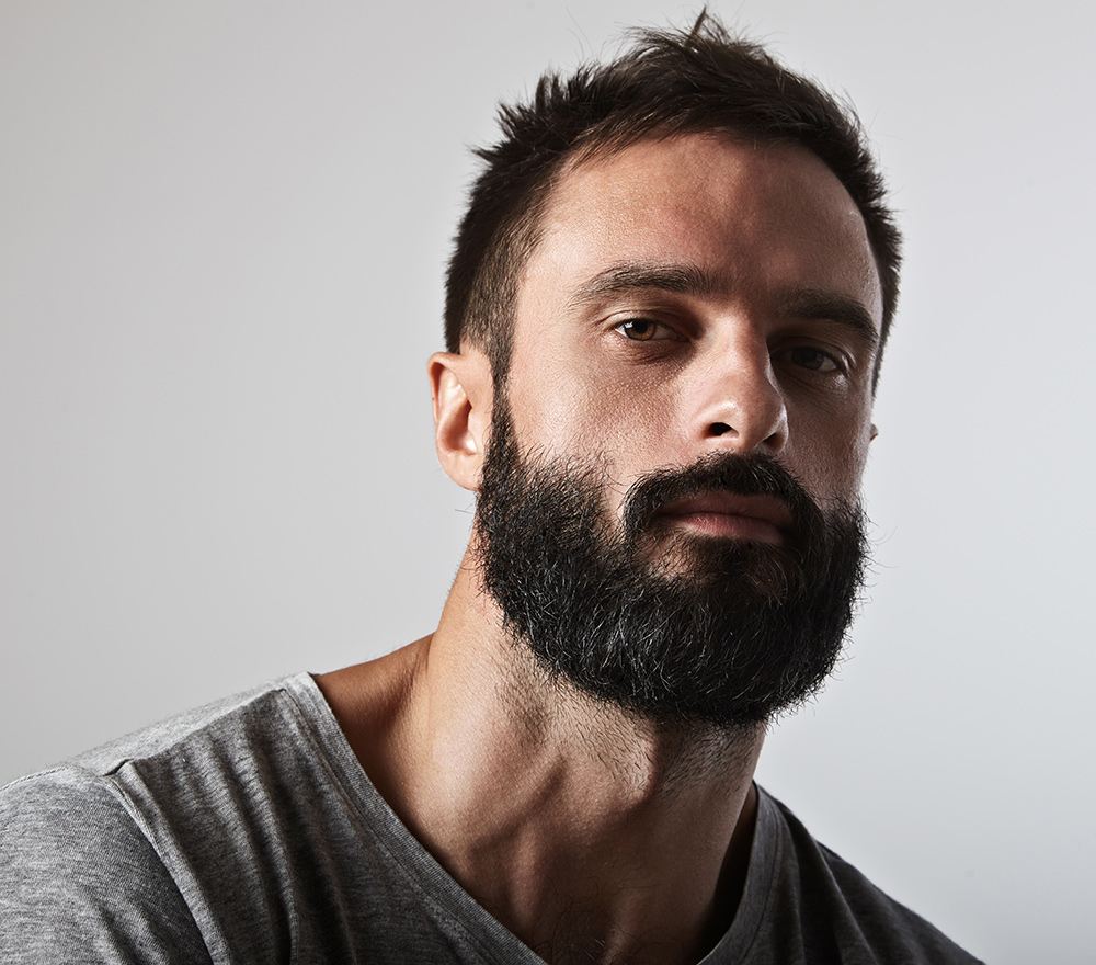Facial hair Transplant | Beard Transplant | Follicular Unit Extraction | Fuller, Thicker Beard | Natural Results | Male Hair Loss Treatment | AZ Hair Restoration Raleigh, North Carolina
