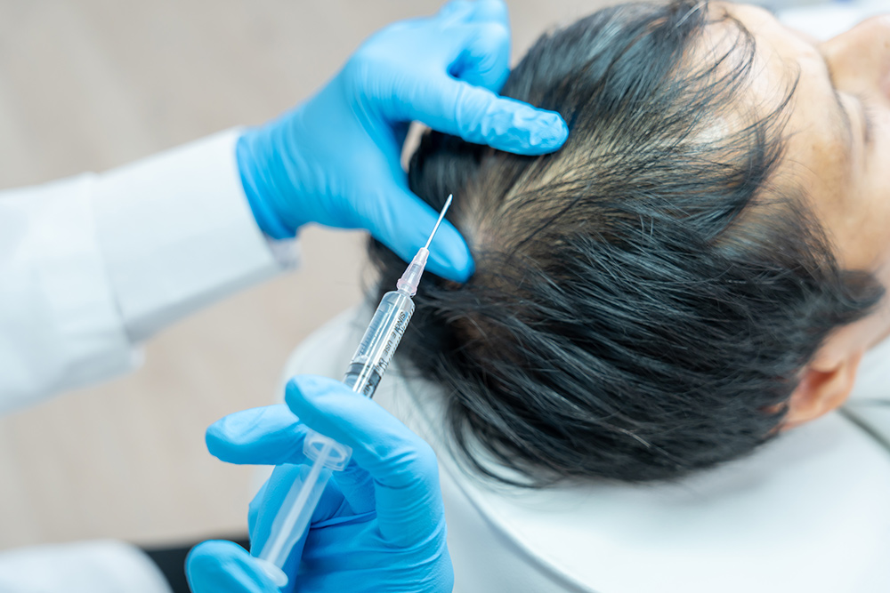 Non-Surgical Hair Restoration | Growth Factor Therapy | Medical Hair Loss Treatment | AZ Hair Restoration Raleigh NC