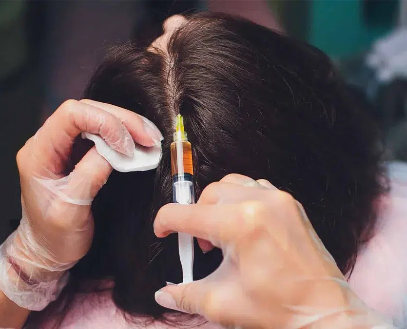 Growth Factor Therapy For Balding & Hair Loss | Medical Hair Growth Treatment For Men & Women | Regrow Your Hair | AZ Hair Restoration Raleigh, North Carolina