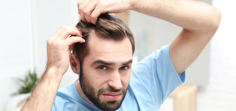 What Is A Receding Hairline | Symptoms, Signs, Causes & Treatment Options | Hair Loss Clinic | AZ Hair Restoration Rayleigh, North Carolina
