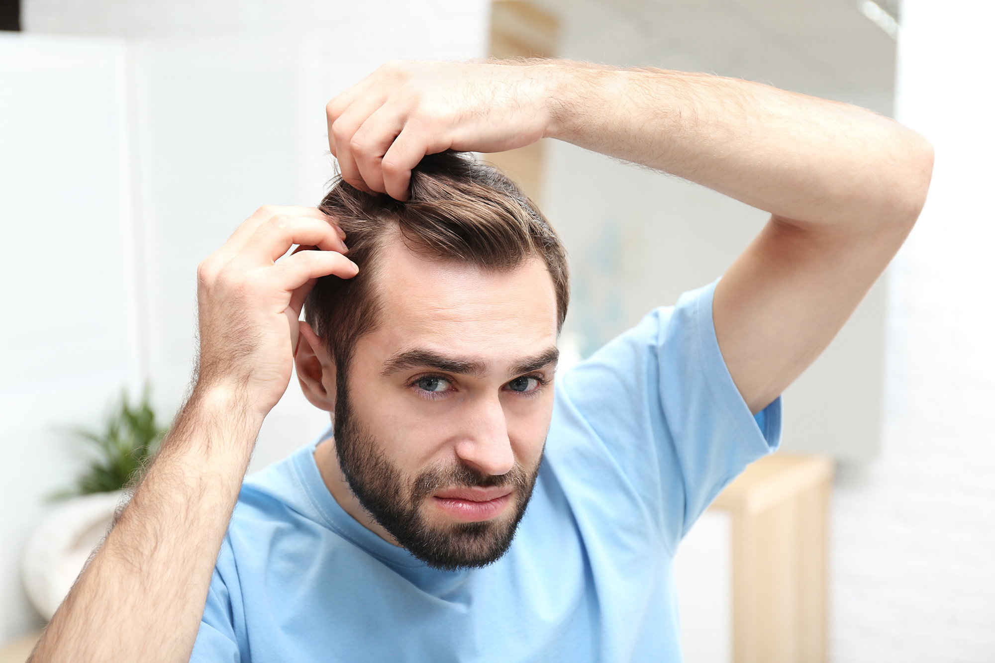 What Is a Receding Hairline? Signs, Causes & What You Can Do About It