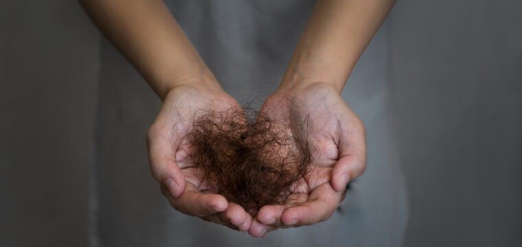 Does Diabetes Cause Hair Loss | Medication | Hormones | Immune System | Medical Hair Regrowth | Hair Loss Clinic | AZ Hair Restoration Raleigh North Carolina