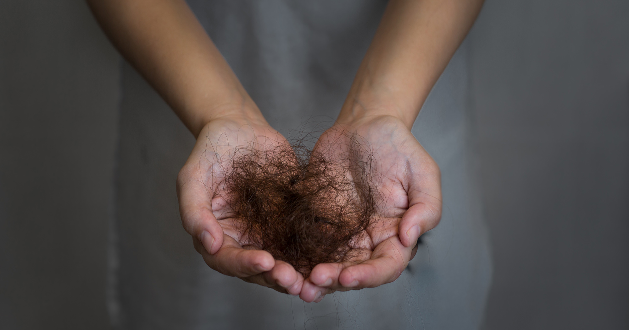 Does Diabetes Cause Hair Loss? The Surprising Truth Revealed!