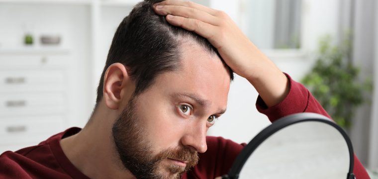 Hair Transplant Options | Best Hair Transplant Technique | FUE | FUT | MFU | AZ Hair Restoration | Wake County, NC