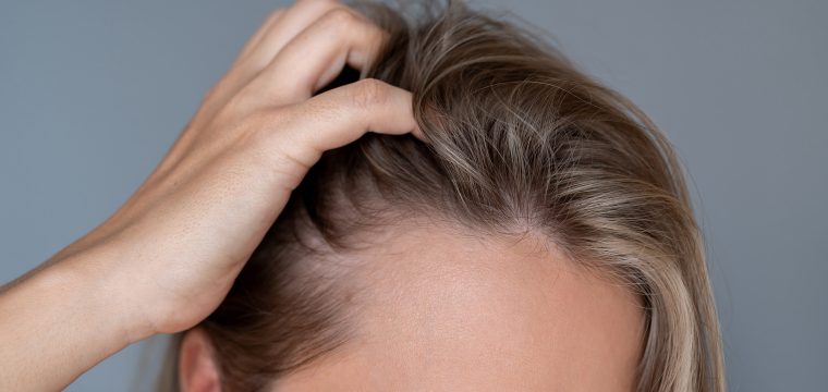 Early Balding Signs | First Signs Of Thinning Hair | Medical Hair Growth Treatments | Hair Transplant Clinic | AZ Hair Restoration Raleigh, NC