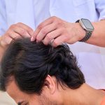 How To Prepare For A Hair Transplant Consultation With A Doctor | Raleigh, NC | AZ Hair Restoration