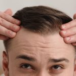 Mature Hairline VS Receding Hairline | Genetic Baldness | Male & Female Hair Loss | AZ Hair Restoration In Raleigh, NC