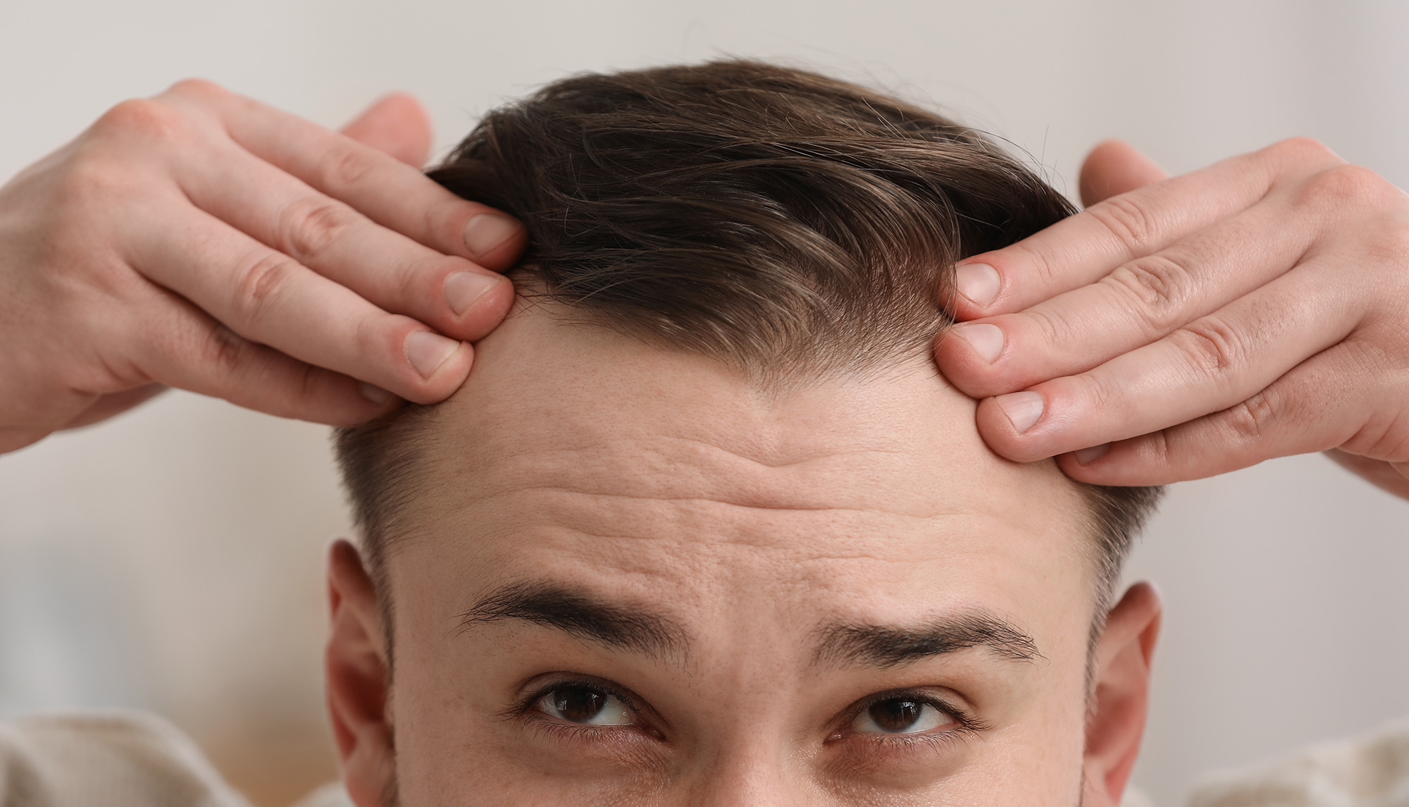Mature Hairline vs Receding? How to Tell the Difference