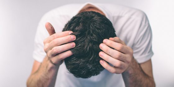 Does Creatine Cause Hair Loss | Male Pattern Balding | Hair Thinning Causes | Hair Transplant Clinic | ZA Hair Restoration Raleigh, North Carolina Does Creatine Cause Hair Loss | Male Pattern Balding | Hair Thinning Causes | Hair Transplant Clinic | ZA Hair Restoration Raleigh, North Carolina