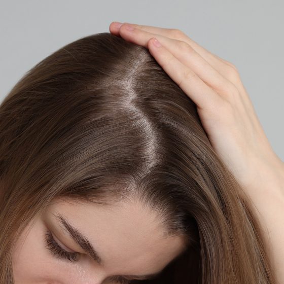 Best Scalp Care Routine & Tips For Hair Growth In Men & Women | Hair Loss Clinic | AZ Hair Restoration Raleigh, NC